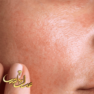 تشخیص نوع پوست |میکاپ صورت | آموزش میکاپ صورت | بهترین مربی میکاپ | عسل بهادری